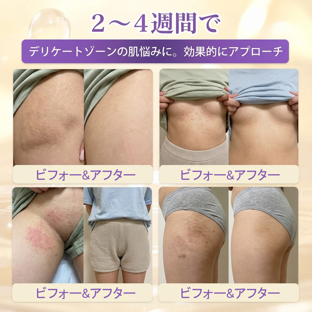 日本製・国内発送✨ 𝐆𝐎𝐋𝐃𝐊𝐈𝐒𝐒® 𝐆𝐇𝐊-𝐂𝐮 & 𝐁𝐈𝐎𝐓𝐈𝐍 𝟏𝟎-𝐈𝐍-𝟏⭐「ゴールドキッス ® GHK-Cu ＆ ビオチン 10-in-1」スキンリストアクリーム⚡贅沢な美容成分が 1 つに凝縮！