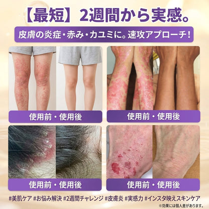 日本製・国内発送✨ 𝐆𝐎𝐋𝐃𝐊𝐈𝐒𝐒® 𝐆𝐇𝐊-𝐂𝐮 & 𝐁𝐈𝐎𝐓𝐈𝐍 𝟏𝟎-𝐈𝐍-𝟏⭐「ゴールドキッス ® GHK-Cu ＆ ビオチン 10-in-1」スキンリストアクリーム⚡贅沢な美容成分が 1 つに凝縮！