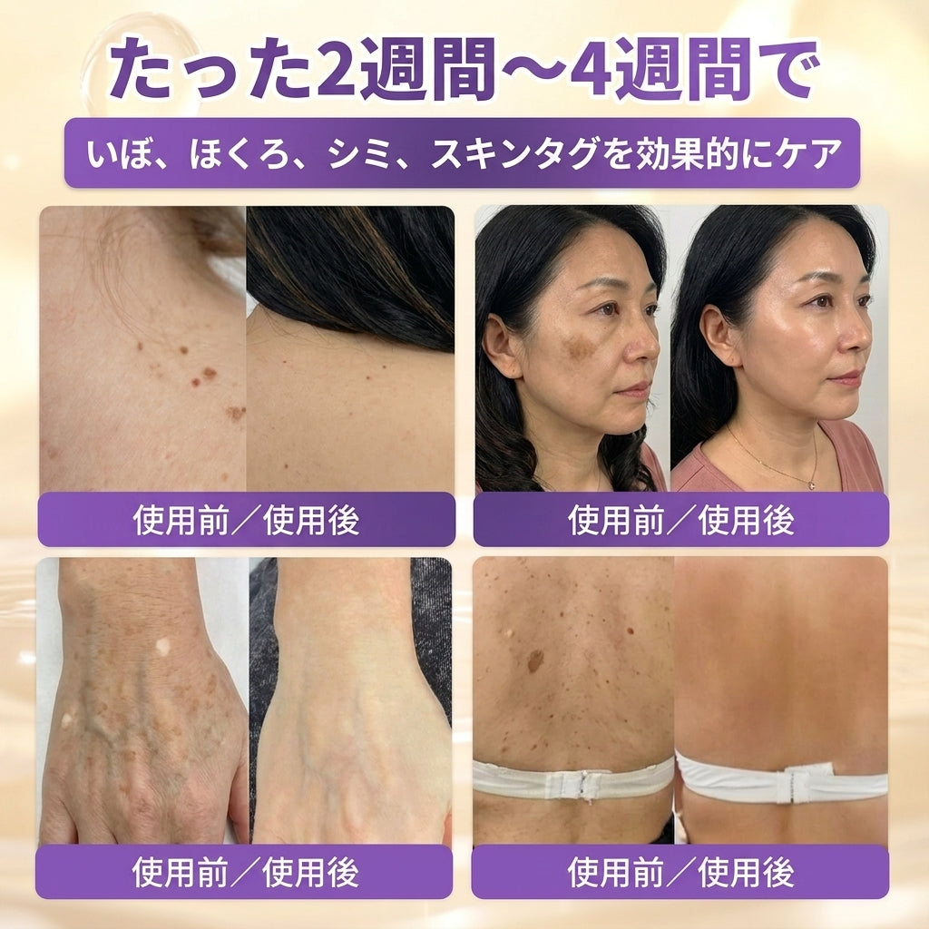 日本製・国内発送✨ 𝐆𝐎𝐋𝐃𝐊𝐈𝐒𝐒® 𝐆𝐇𝐊-𝐂𝐮 & 𝐁𝐈𝐎𝐓𝐈𝐍 𝟏𝟎-𝐈𝐍-𝟏⭐「ゴールドキッス ® GHK-Cu ＆ ビオチン 10-in-1」スキンリストアクリーム⚡贅沢な美容成分が 1 つに凝縮！