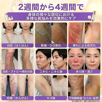 日本製・国内発送✨ 𝐆𝐎𝐋𝐃𝐊𝐈𝐒𝐒® 𝐆𝐇𝐊-𝐂𝐮 & 𝐁𝐈𝐎𝐓𝐈𝐍 𝟏𝟎-𝐈𝐍-𝟏⭐「ゴールドキッス ® GHK-Cu ＆ ビオチン 10-in-1」スキンリストアクリーム⚡贅沢な美容成分が 1 つに凝縮！