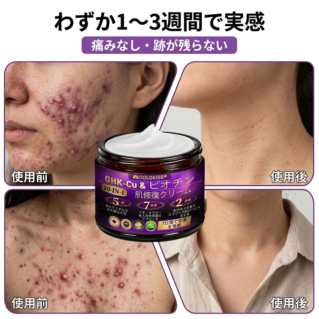 日本製・国内発送✨ 𝐆𝐎𝐋𝐃𝐊𝐈𝐒𝐒® 𝐆𝐇𝐊-𝐂𝐮 & 𝐁𝐈𝐎𝐓𝐈𝐍 𝟏𝟎-𝐈𝐍-𝟏⭐「ゴールドキッス ® GHK-Cu ＆ ビオチン 10-in-1」スキンリストアクリーム⚡贅沢な美容成分が 1 つに凝縮！