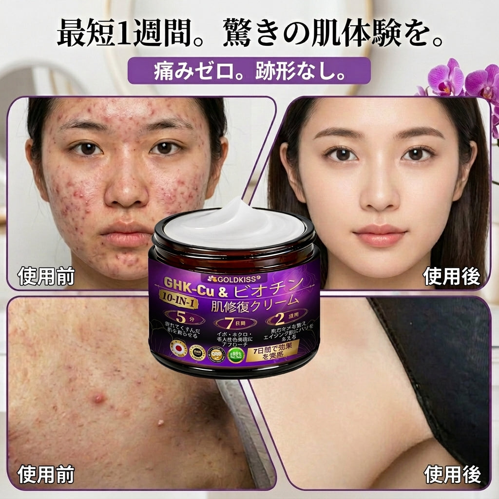 日本製・国内発送✨ 𝐆𝐎𝐋𝐃𝐊𝐈𝐒𝐒® 𝐆𝐇𝐊-𝐂𝐮 & 𝐁𝐈𝐎𝐓𝐈𝐍 𝟏𝟎-𝐈𝐍-𝟏⭐「ゴールドキッス ® GHK-Cu ＆ ビオチン 10-in-1」スキンリストアクリーム⚡贅沢な美容成分が 1 つに凝縮！